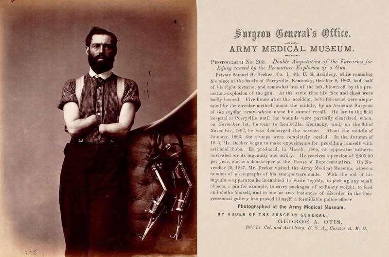 Surgical Photograph… prepared under the supervision of… War Department, Surgeon General’s Office, Army Medical Museum. <br />
