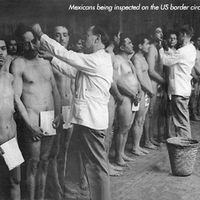 mexicans being inspected for lice 1920s.jpg